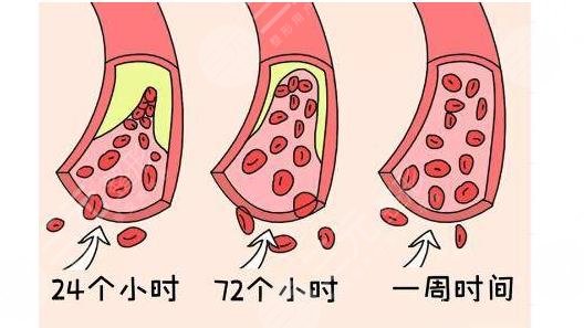 <b>手指再造</b>