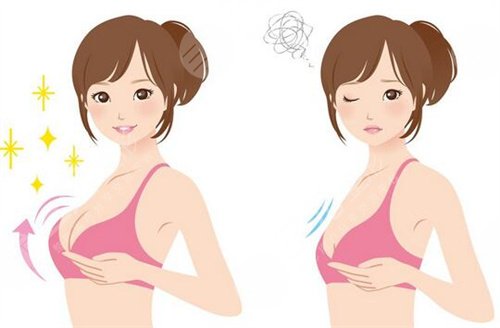 <b>乳房下垂矫正的常见方法</b>