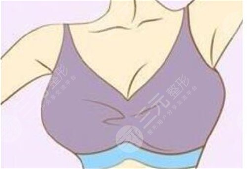 <b>乳晕大小不一样怎么办</b>