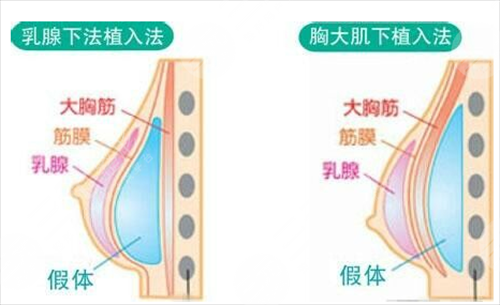<b>百色乳头凹陷怎么矫正啊</b>