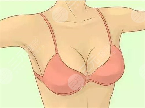 胸部整形多少钱？成都隆胸、乳房矫正、乳头造型价格参考表