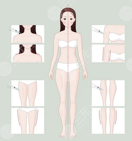 火凤凰溶脂和冷冻哪个好？优缺点对比+注意事项，术前必看！