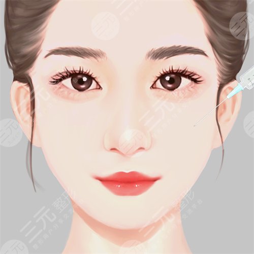 自体脂肪丰苹果肌有风险吗 自体脂肪丰苹果肌前后对比图