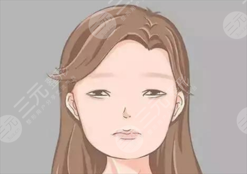 去颊脂垫术前该做些什么呢