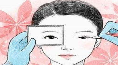 韩式眼睑内外翻矫正术的优势