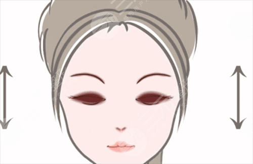 眼皮松弛手术 让眼部“紧”起来 眼皮松弛手术 让眼部“紧”起来