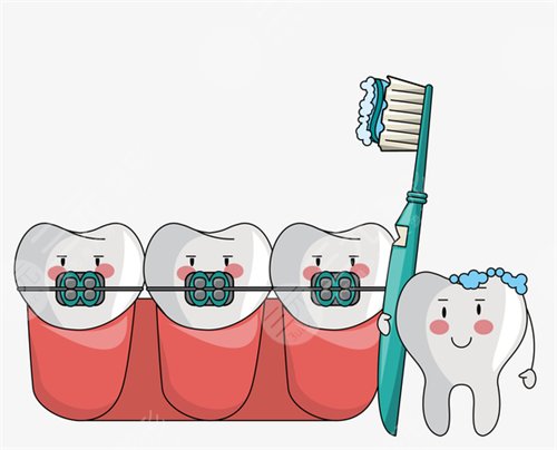 牙科私人贵还是医院贵?带牙套多久才有果?