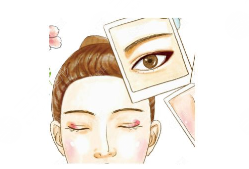 眼睑下垂有什么好办法 眼睑下垂有什么好办法