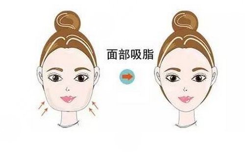 打B****果如何 会不会很疼