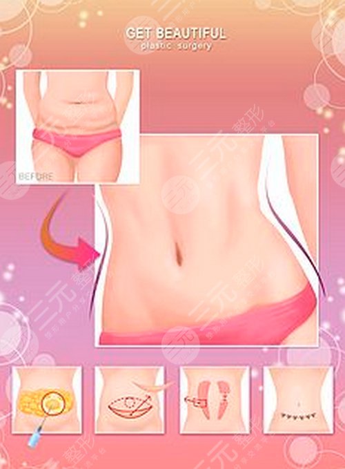 水桶腰怎么减