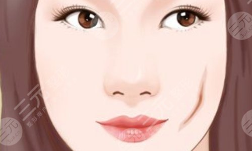 哪些人不能做光子嫩肤 哪些人不能做光子嫩肤