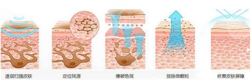 医院点痦子多少钱一颗？激光祛痦子真实果分享