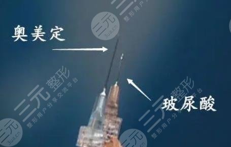 奥美定后遗症在多久后发生？奥美定隆胸能活多久？注射性医美盘点！